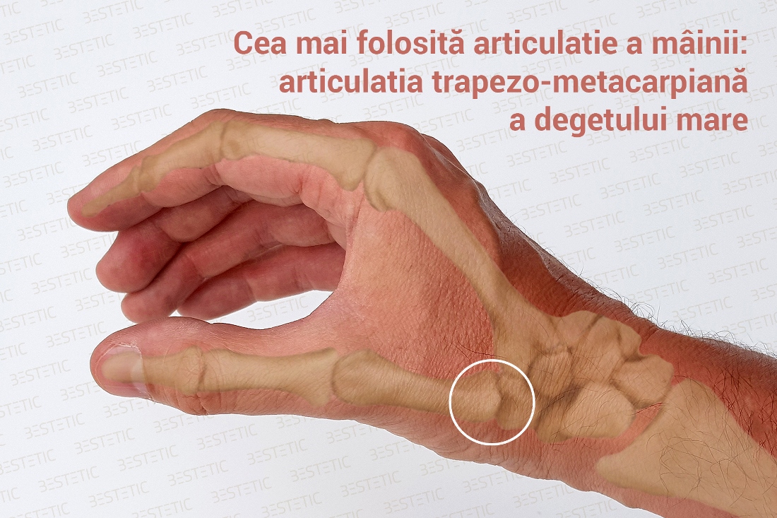 Epifanov V A Artroza articulațiilor mâinii și piciorului