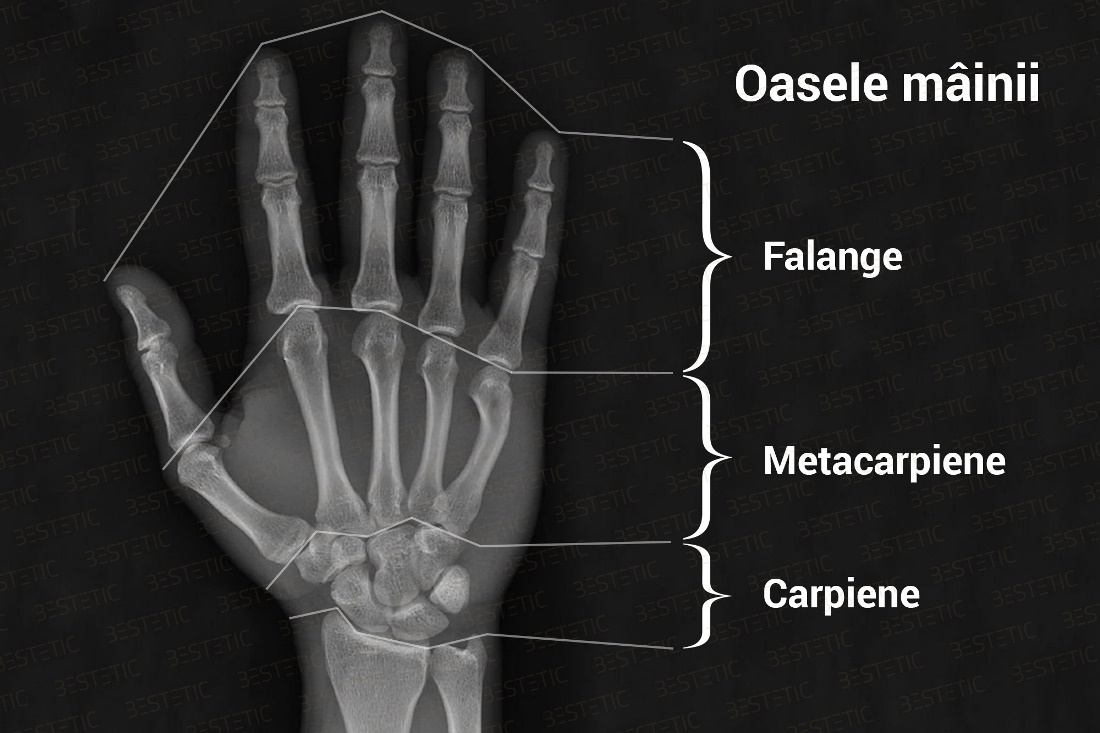Durere de fractură la încheietura mâinii. durere fractura mana