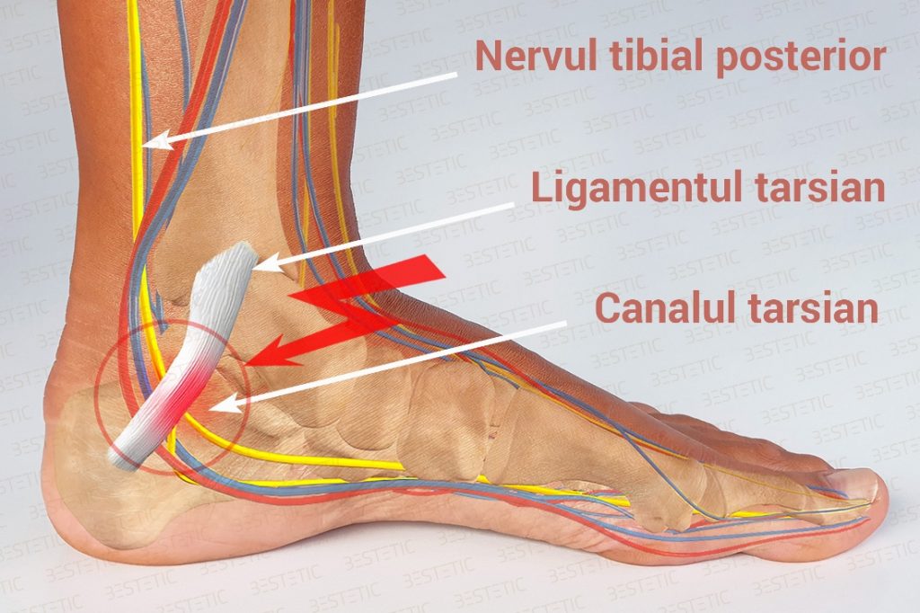 nerv tibial posterior