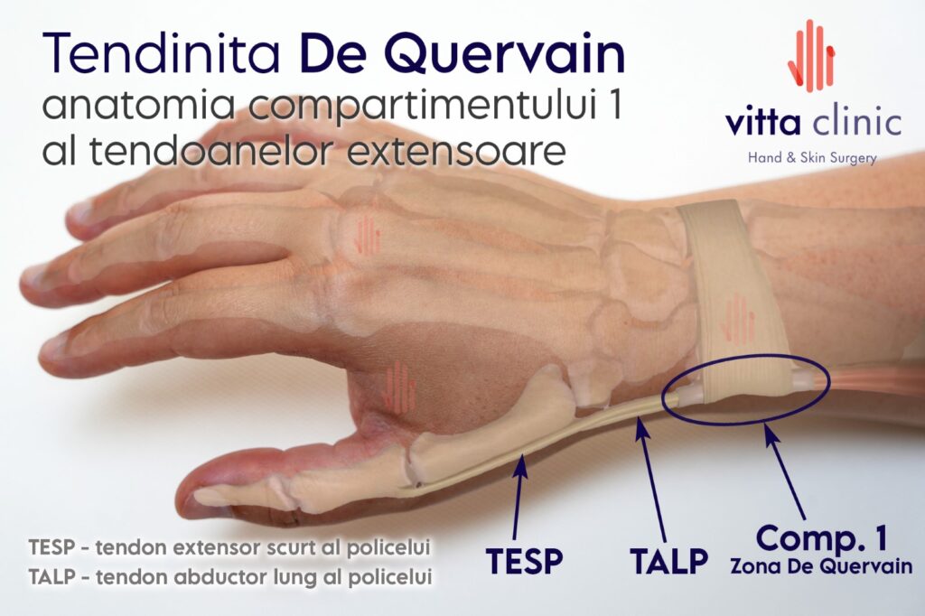 Anatomia compartimentului 1 extensor in tendinita De Quervain - Vitta Clinic