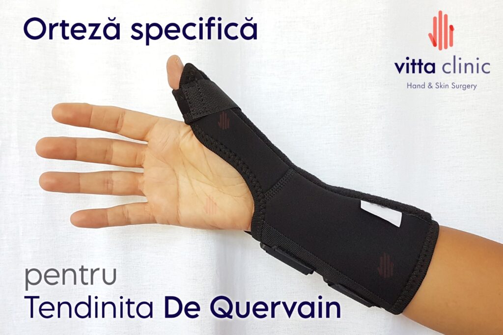 Orteza specifica de imobilizare pentru tendinita De Quervain - Vitta Clinic